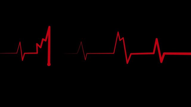 Abnormal heart rhythm line showing an ekg style medical waveform animation
