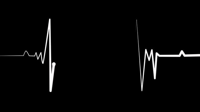 Heartbeat line irregular electrocardiogram signal animation