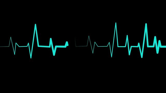 Heartbeat line on graph paper showing an ecg style rhythm pattern animation