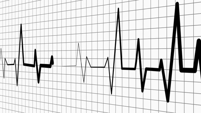 Heartbeat line on graph paper showing an ecg style rhythm pattern animation