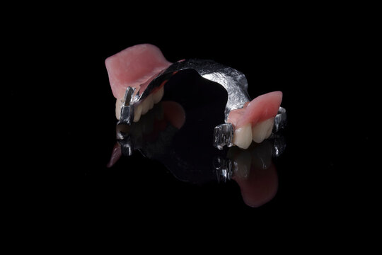 Dentistry tools and models on a black background. 