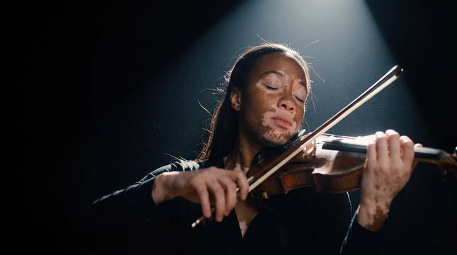 Confident violinist with visible vitiligo performs passionately under a dramatic spotlight, eyes closed