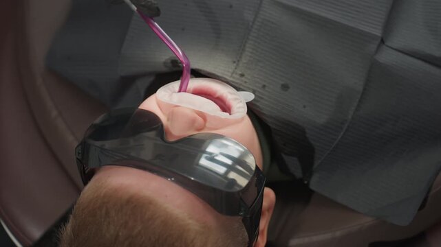 Close up of man lying back with protective eyewear and dental bib as orthodontic tool administers treatment inside his mouth. purple suction tube is visible within open oral cavity
