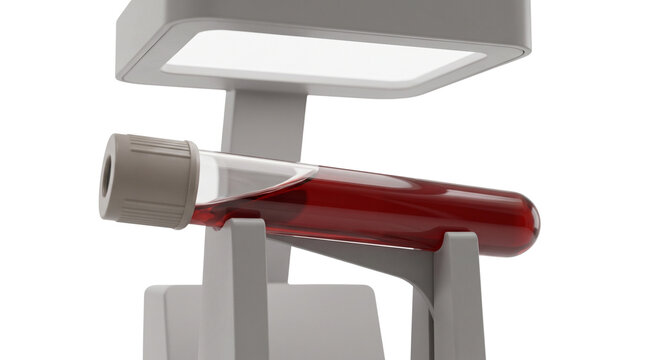Medical blood sample in test tube, laboratory diagnostic equipment, clinical hematology research tool for healthcare testing isolated PNG with Transparent Background