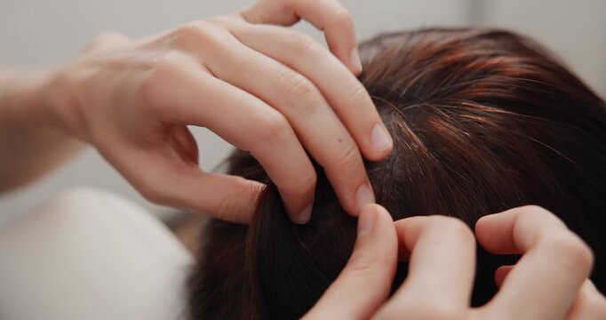 Close view of scalp and hair parting during clinical examination for trichology clinic, top view.