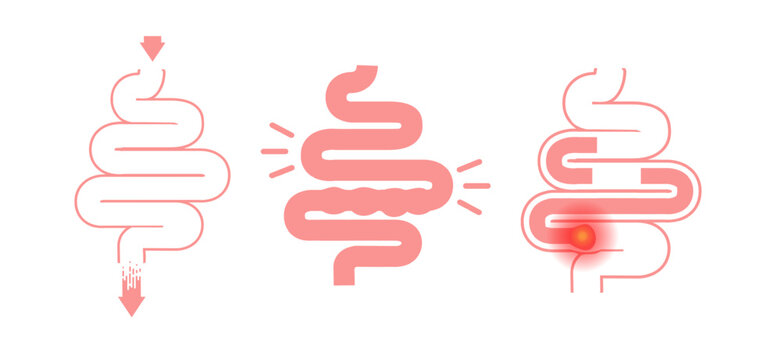 Gut Health Digestive System Anatomy Vector Illustration with Stomach and Intestines.