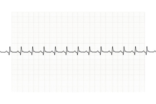 Black heartbeat ekg line graph over a faint white grid pattern isolated on a transparent background cardiology