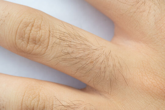 Hairy human skin, close view of male arm or leg, body hair, natural fur pattern
