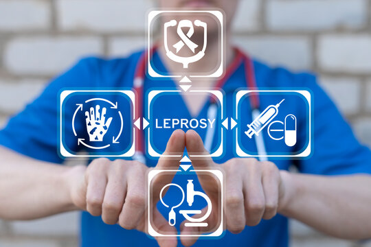 Concept of leprosy disease awareness. Leprosy treatment health care innovation.