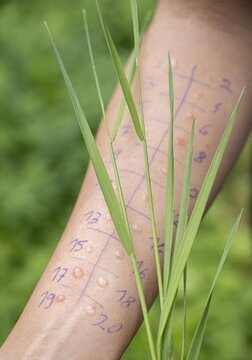 Allergy test, prick test, skin test, different ingredients are tested for allergic reactions, arm with markings and blades of grass, Germany