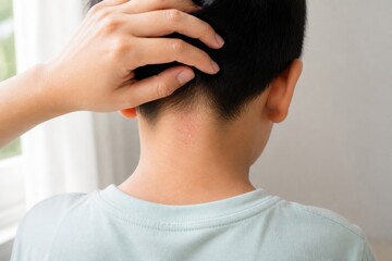 Fototapeta premium Caregiver examining heat rash on child's neck