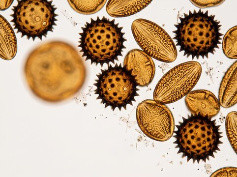 Sculptured pollen grains under transmitted light