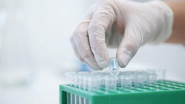 Scientist in protective gloves handling lab samples, conducting research in a sterile environment