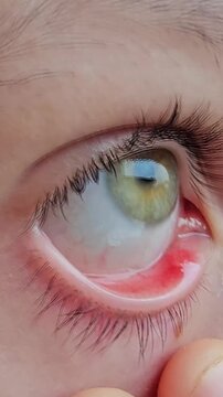 Interesting eye movements captured close up with clear details of the eyes in focus