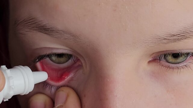 Applying eye drops to relieve discomfort for a child at home in the afternoon