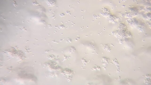 Microscopic view of active lactic bacteria and casein culture in yogurt under light microscope