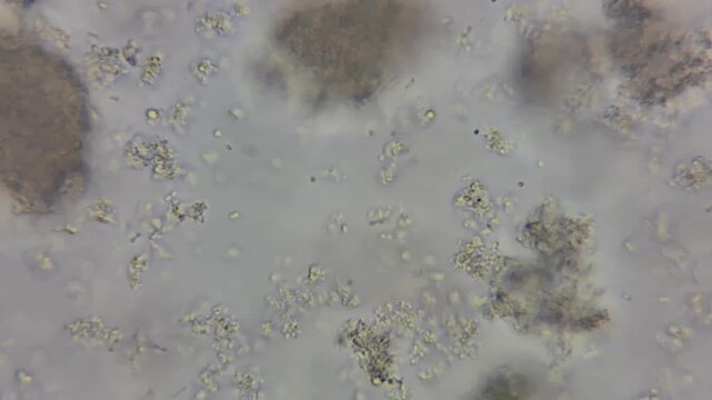 Microscopic view of active lactic bacteria and casein culture in yogurt under light microscope