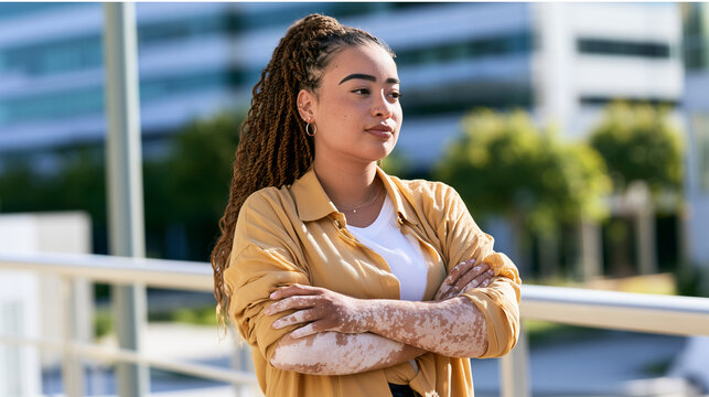 Woman with visible vitiligo patches standing outdoors with arms crossed and looking away with a serious expression, depigmented skin, facial patches, hand pigmentation, autoimmune
