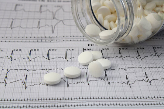 Open bottle of aspirin on electrocardiogram