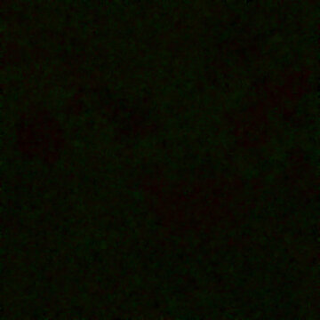 Abstract dark green texture with grainy film noise effect