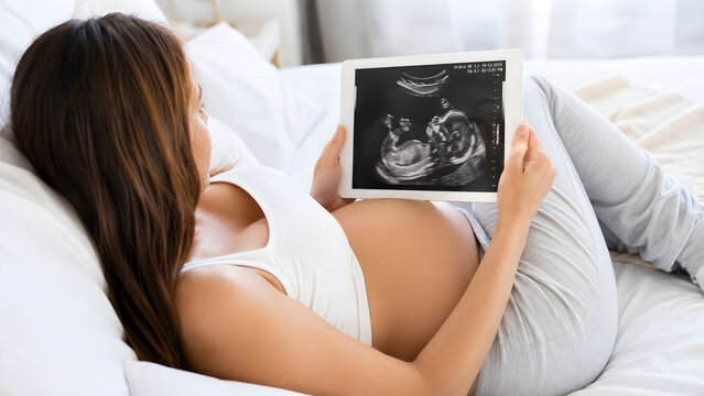 Pregnant woman viewing an ultrasound image at home, representing prenatal care, maternal health, fetal development, and joyful anticipation of motherhood
