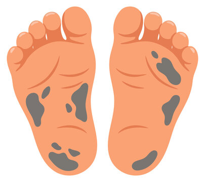 Pair of dirty human feet illustration