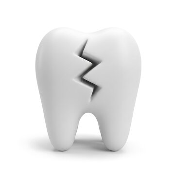 3D render illustration of broken white tooth with zigzag crack isolated on white background
