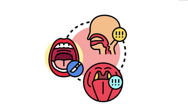Human throat anatomy showing medical conditions, sore throat, and tonsillitis problems, highlighting symptoms and healthcare complications