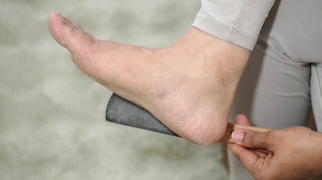 Home foot care with a foot file