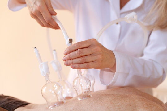 Female alternative practitioner treating senior woman with vacuum cupping therapy