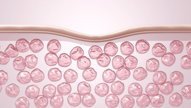 damaged skin cross section showing collagen volume loss pink 3d render