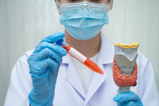 Doctor holding thyroid gland model and blood sample test tube in laboratory.