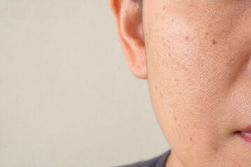 Naklejka premium Close-Up Portrait of Mature Woman’s Facial Skin with Visible Texture and Blemishes, Copy Space.