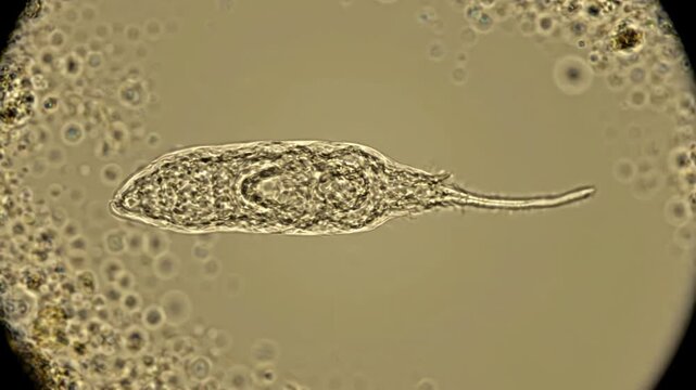Trypanosoma cruzi parasite slowly moving through a clean biological fluid environment, the parasite maintains a consistent elongated body and thin flagellum throughout the entire shot