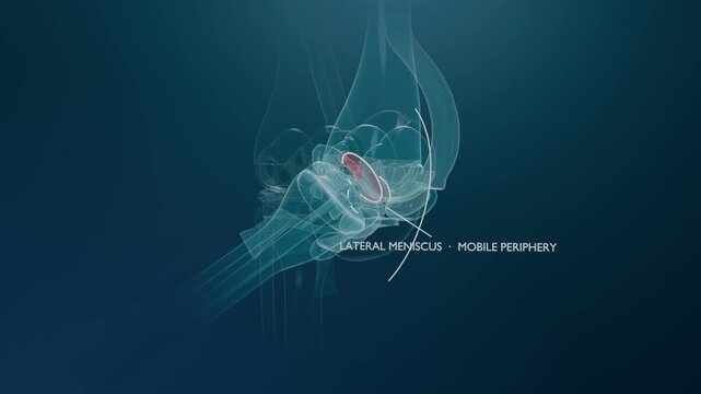 On play, rotating knee model revealing red lateral meniscus showing mobile periphery with arc label