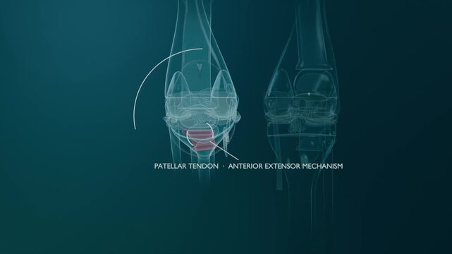 Animating left knee revealing patellar tendon as arc sweeping in over teal gradient