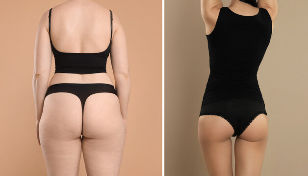 Overweight and fit woman, before and after collage on dark beige background. Weight loss result