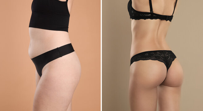 Overweight and fit woman, collage on dark beige background. Weight loss result