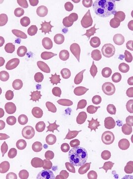 Microscopic View Of Blood Cells Showing Various Shapes And Sizes Illustrating Health Conditions