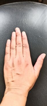 f left hand fifty year old woman 