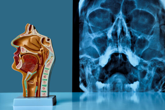 Human nasal cavity anatomy model stands beside sinus X-ray in medical clinic. ENT diagnosis and patient examination
