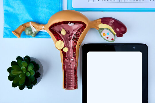 Female reproductive system anatomical model with blank tablet screen. Gynecological consultation and patient care