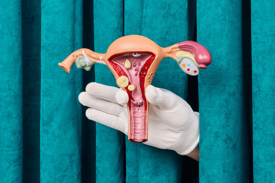 Doctor presenting female reproductive organ pathology and ovarian cyst structure. Women health screening and endometriosis prevention strategy.