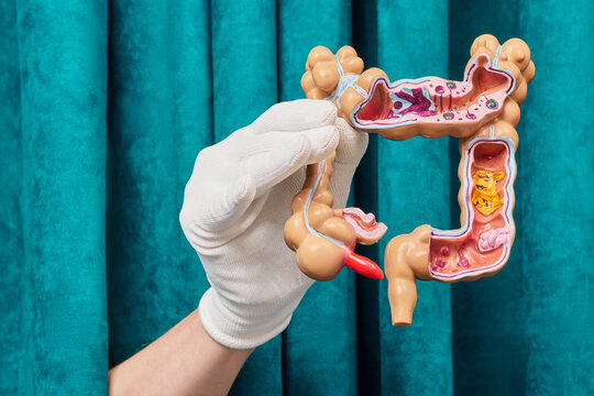 Visualizing digestive system pathology and bowel mucosa against curtain. Digestive tract health assessment and constipation relief.