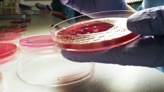 Gloved hands steady red agar petri dish above clean laboratory bench, with blue tool touching surface and open culture plates nearby, with laboratory, petri, dish, agar detail, showing glove, hand