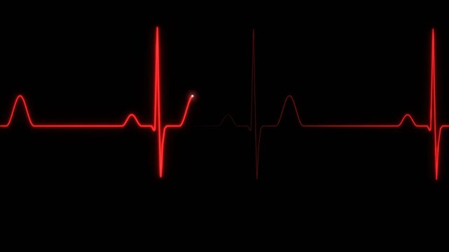 Red ECG line going flat between heartbeats on a black background, for medical monitoring and emergency themes