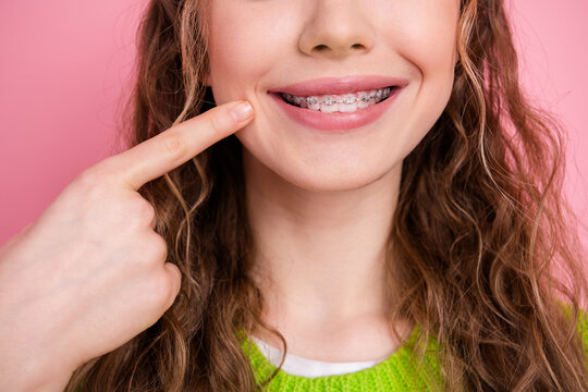 Young girl with braces pointing at her smile against pink background wearing a bright green sweater
