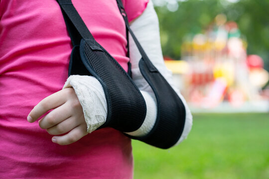 Close up girl arm, bone fracture in cast and sling. Immobilization of elbow joint with splint. Childhood injury and safety concept