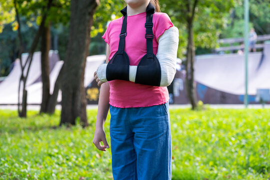 Girl with bone fracture in full arm cast and sling standing near skatepark summer. Childhood injury and safety concept