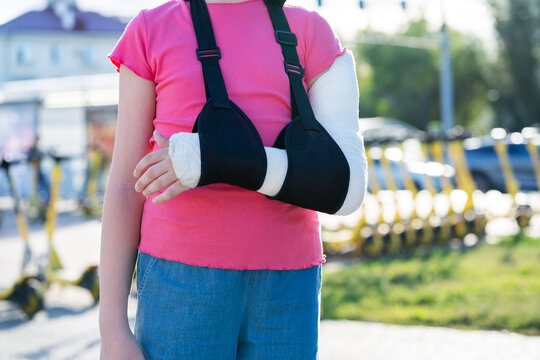 Unrecognizable girl with broken arm in plaster cast and sling standing near parking lot of electric scooters, child injury and urban safety concept